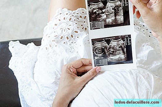 다운 스페인의 데이터에 따르면 다운 증후군 진단 전에 거의 모든 부부가 임신을 끝내기로 결정합니다.