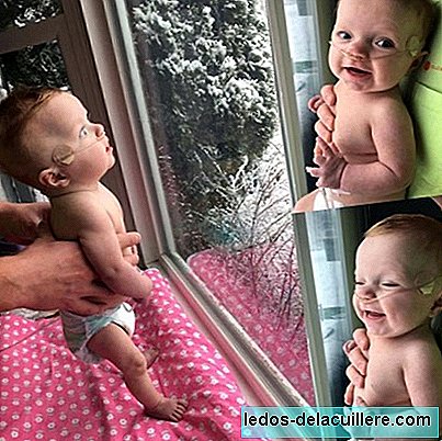 Share the photos of your five-month-old baby watching snow for the first time after being told he would have an abortion