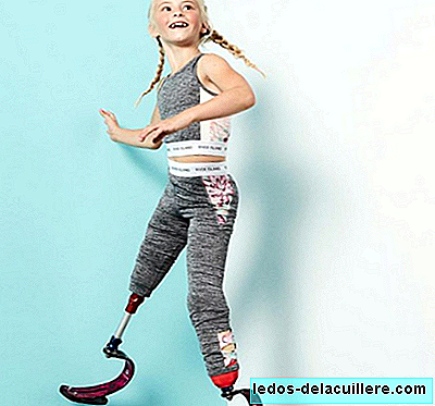 With seven years, this model girl without legs is an example of overcoming