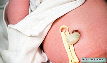 Umbilical cord: what are the warning signs that we must monitor