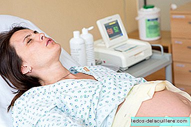 When the epidural has no effect: lateralization of anesthesia
