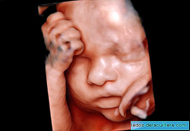 5D or 4D HDlive ultrasound: super realistic images of your baby
