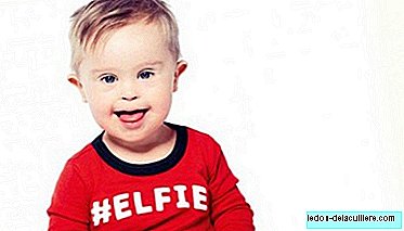 Das Baby, das sie für eine Anzeige wegen Down-Syndroms abgelehnt hatten, spielt jetzt eine Hauptrolle in einer Werbekampagne