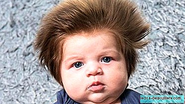 Bayi berusia sembilan minggu dengan banyak rambut yang telah menjadi virus