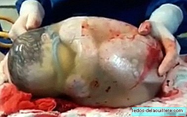 De fascinerende video van een baby die in de tas is geboren en beweegt zonder te weten dat hij er al is