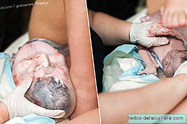 The incredible birth with the amniotic sac captured by a professional photographer