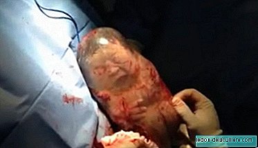 The amazing video of a baby that is born inside the bag and moves without knowing that he was born