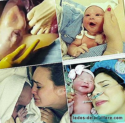 O incrível vídeo do nascimento por cesariana de um bebê dentro de seu saco amniótico
