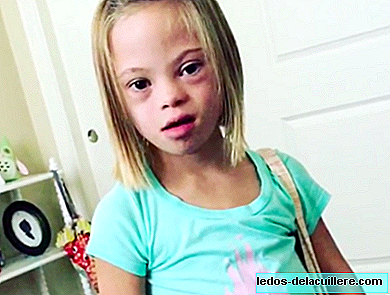 "متلازمة داون ليست مخيفة ، إنها مثيرة": الرسالة الملهمة لفتاة في السابعة من عمرها مصابة بالاضطراب