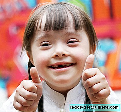 In Iceland only two children are born on average every year with Down Syndrome