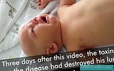 Halka aşılama hakkında farkındalık yaratmak için boğmaca ile bebeğinizin son günlerinin çirkin bir videosunu yapıyorlar