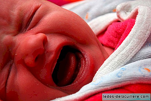 'Sarsılmış Bebek Sendromu' nedeniyle kör olabilecek bir bebeği ağırlıyorlar