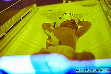 Жутица новорођенчади: врло уобичајено стање код новорођенчади
