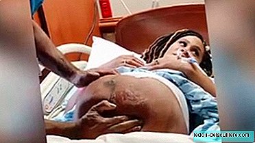 Vídeo incrível de uma versão cefálica externa para transformar o bebê que vem de nádegas