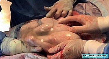 Amazing veiled delivery of triplets: one of the babies is born inside the amniotic bag and they watch for seven minutes as it is inside the uterus