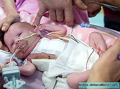 Den britiske babyen som ble født med hjertet ut av kroppen sin, er allerede utskrevet