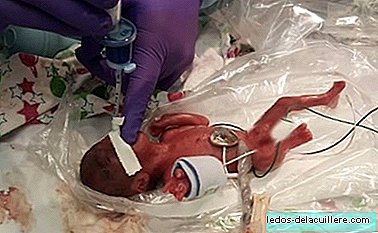 The smallest micropremature baby in the world, weighing 245 grams at birth, was discharged