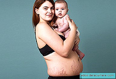 A campanha viral que orgulhosamente celebra a beleza dos corpos pós-parto