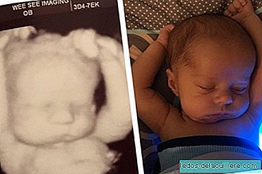 La simpatica foto di un bambino che dorme nella stessa posizione che aveva nell'utero