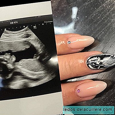 Your baby's ultrasound on the nails, the new fashion that pregnant women wear