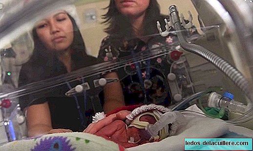 A música emocional de Natal para um bebê prematuro cantada por duas enfermeiras da UTI