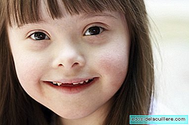 Glück versteht Chromosomen nicht: World Down Syndrome Day