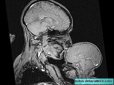 Kisah setelah MRI itu memperlihatkan seorang ibu tidur bayinya