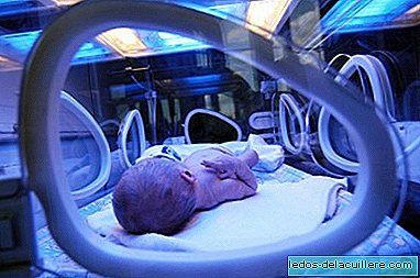 Icterul la nou-născuți ar putea fi un sistem evolutiv de apărare împotriva morții cauzate de sepsis