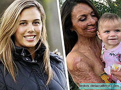 A inspiradora história de superação de Turia Pitt: a ex-modelo que sobreviveu a um incêndio agora é mãe