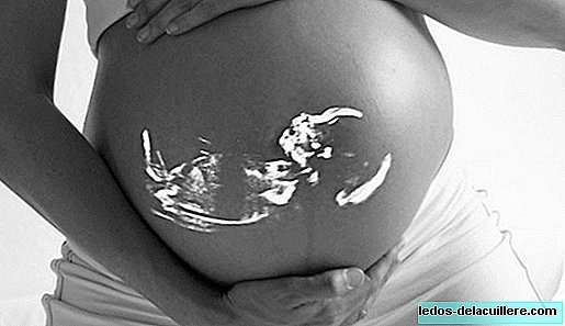 WHO priporoča, da se obiski za nadzor nosečnosti podvojijo od štiri do osem