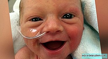 The smile of a premature baby five days after birth that gives hope to hundreds of parents
