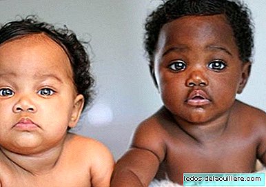 The beautiful twins with different skin color that surprise on Instagram