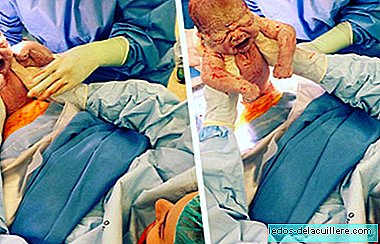 एक सीजेरियन सेक्शन की आश्चर्यजनक तस्वीरें जिसमें माँ अपने चौथे बच्चे को अपने हाथों से निकालती है