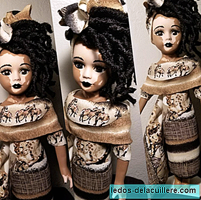Vitiligo-nukud, mis näitavad lastele ilu mis tahes nahatüübis