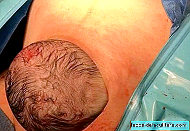 The closest thing to a vaginal delivery: this shows the baby's head in a 'natural caesarean section' (video)