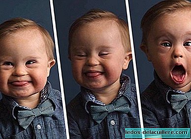 They reject him for an advertising campaign for having Down syndrome and his mother starts a fight on the internet