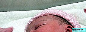 Refleks primer bayi: apa mereka dan mengapa mereka penting