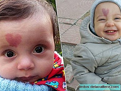 „Љубавна беба“: беба рођена са тачкама у облику срца на челу