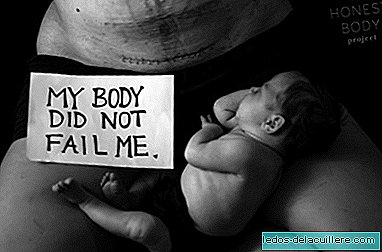 "Meu corpo não me falhou", as fotos impressionantes de uma mãe depois de três cesáreas
