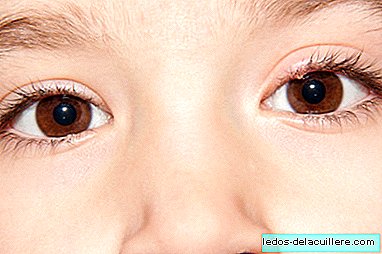 My son has a stye: why it comes out and what to do if it appears