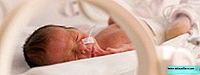 Rođeni između 34. i 36. tjedna: glavni problemi s kojima se suočavaju kasne prerane bebe