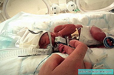 Född mikroprematuro: kom till världen med 27 veckor och 745 gram och har lyckats överleva