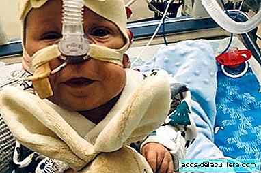 He was born with 23 weeks and 700 grams, and despite many complications, he managed to get ahead