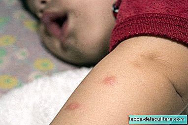 Myggstikk, hvordan beskytte barn