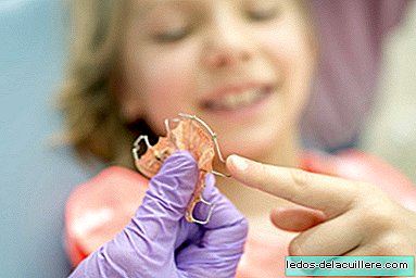 Frequently asked questions about children and orthodontics (or what happens when teeth get messy)