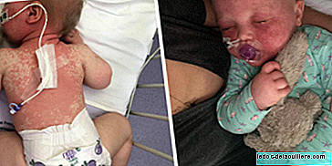 Poste fotos de seu bebê com sarampo para conscientizar sobre a importância de vacinar crianças