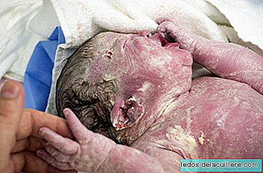 Co je to vernix caseosa a proč je důležité, aby se dítě po narození nevyčistilo
