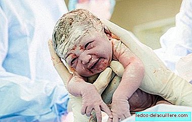 Do you want to take your baby with your own hands in the caesarean section? A mother does it and documents it in photos
