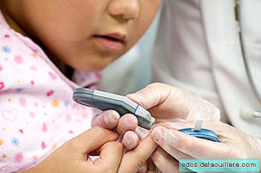 No punctures or invasive methods: they develop a bracelet that measures the blood glucose of diabetic children