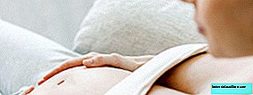 Ein Baby mit Spina Bifida wird in der 27. Schwangerschaftswoche im Mutterleib operiert, wobei eine Schlüssellochoperation durchgeführt wird